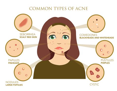 spot.ph|causes of spots in adults.